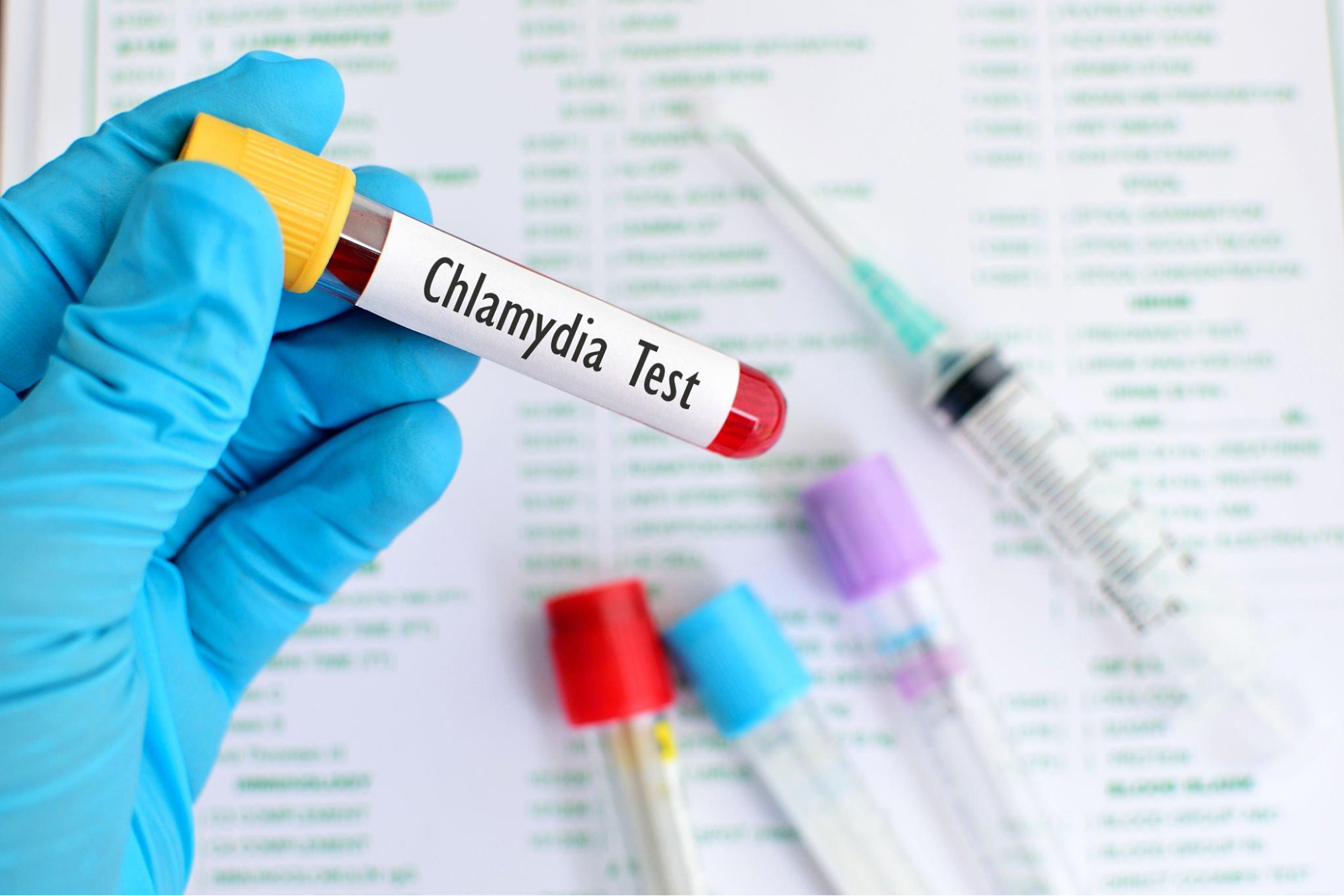 Pencegahan Infeksi Chlamydia